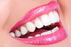 Teeth Whitening | Rockville Centre NY
